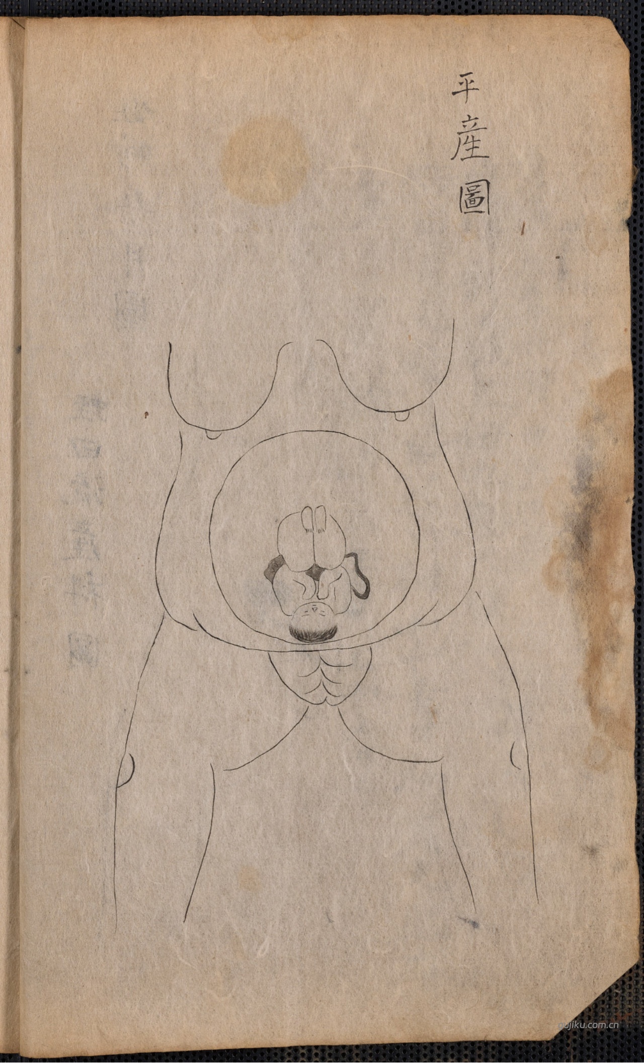 中医产科古籍《蛭田流产科》