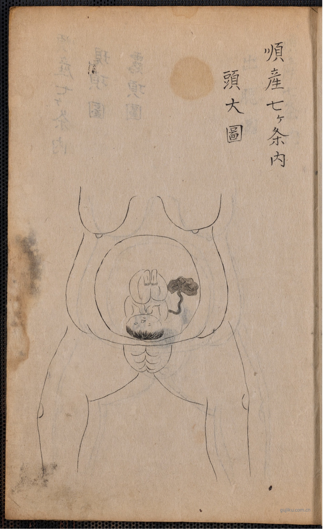 中医产科古籍《蛭田流产科》