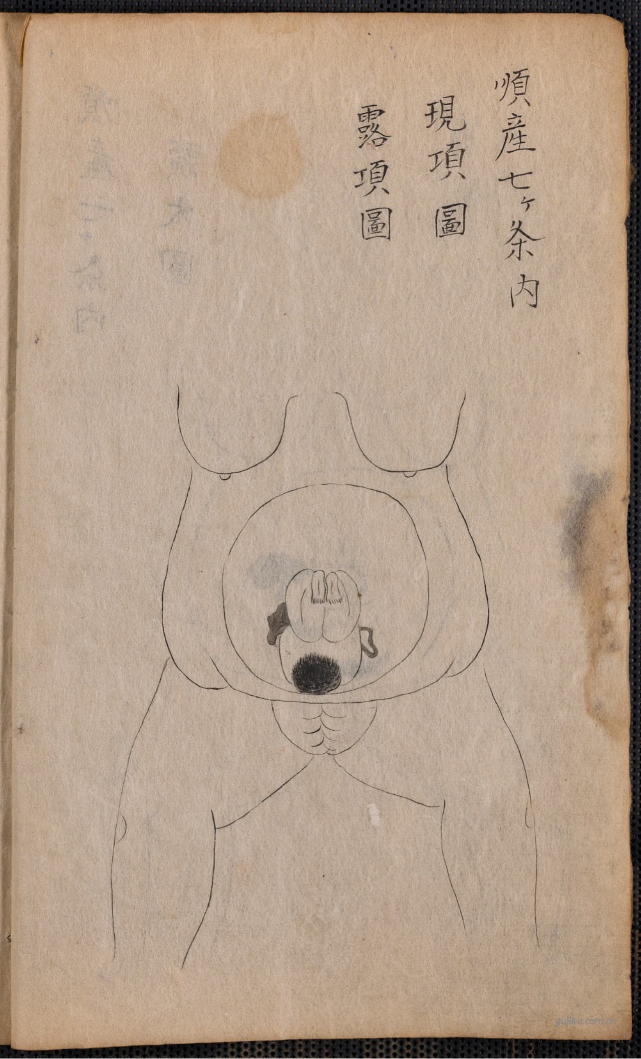 中医产科古籍《蛭田流产科》