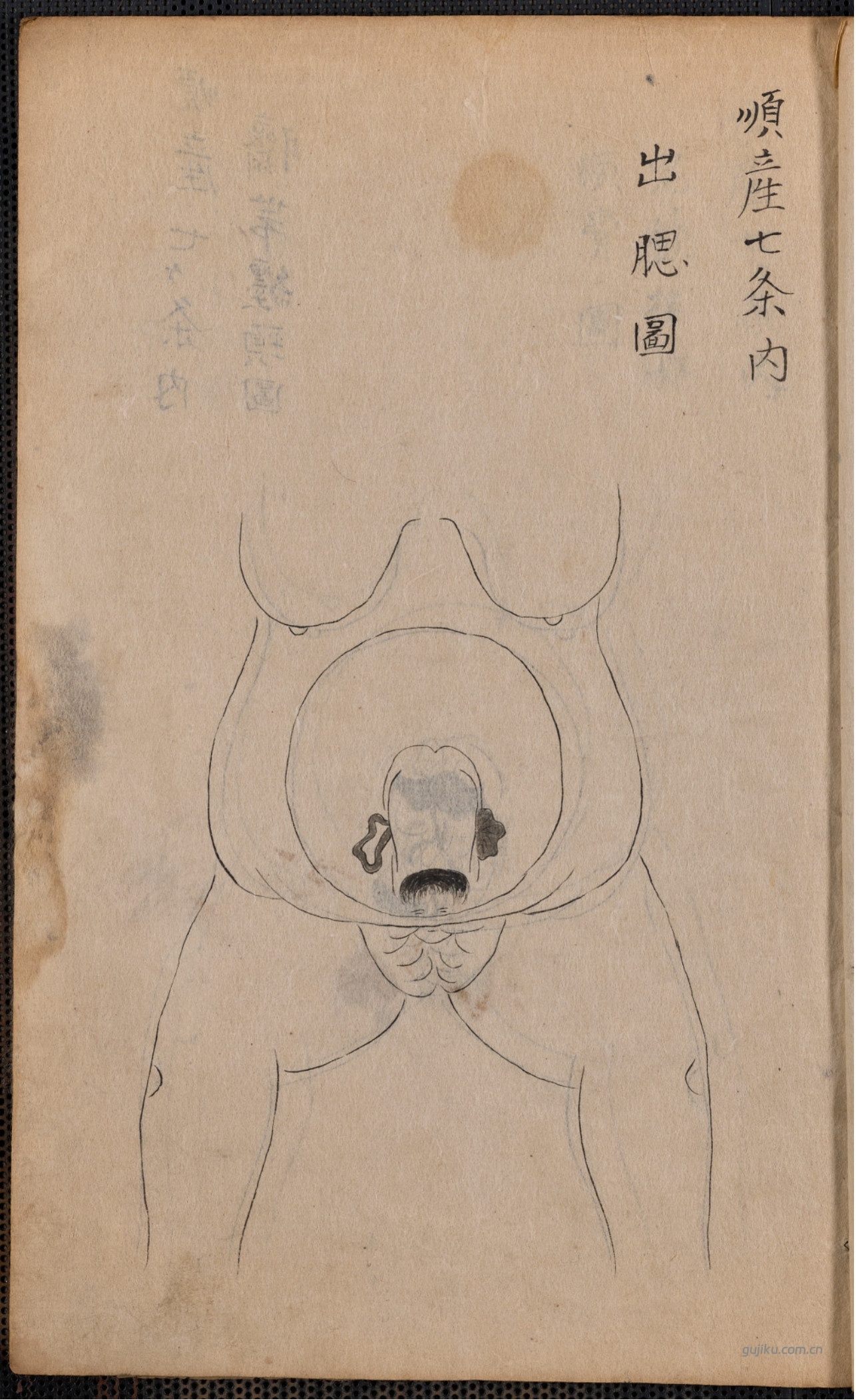 中医产科古籍《蛭田流产科》