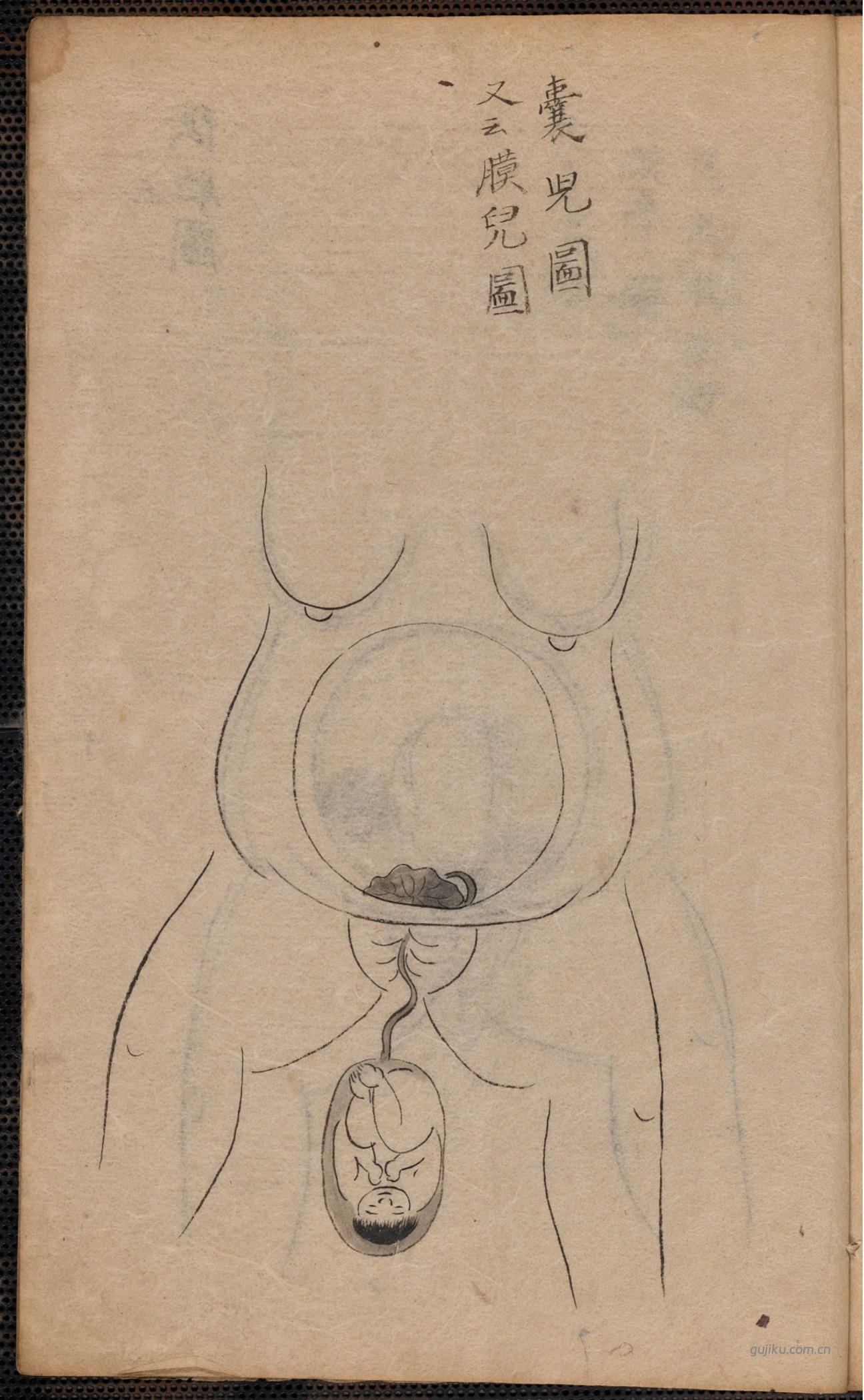 中医产科古籍《蛭田流产科》