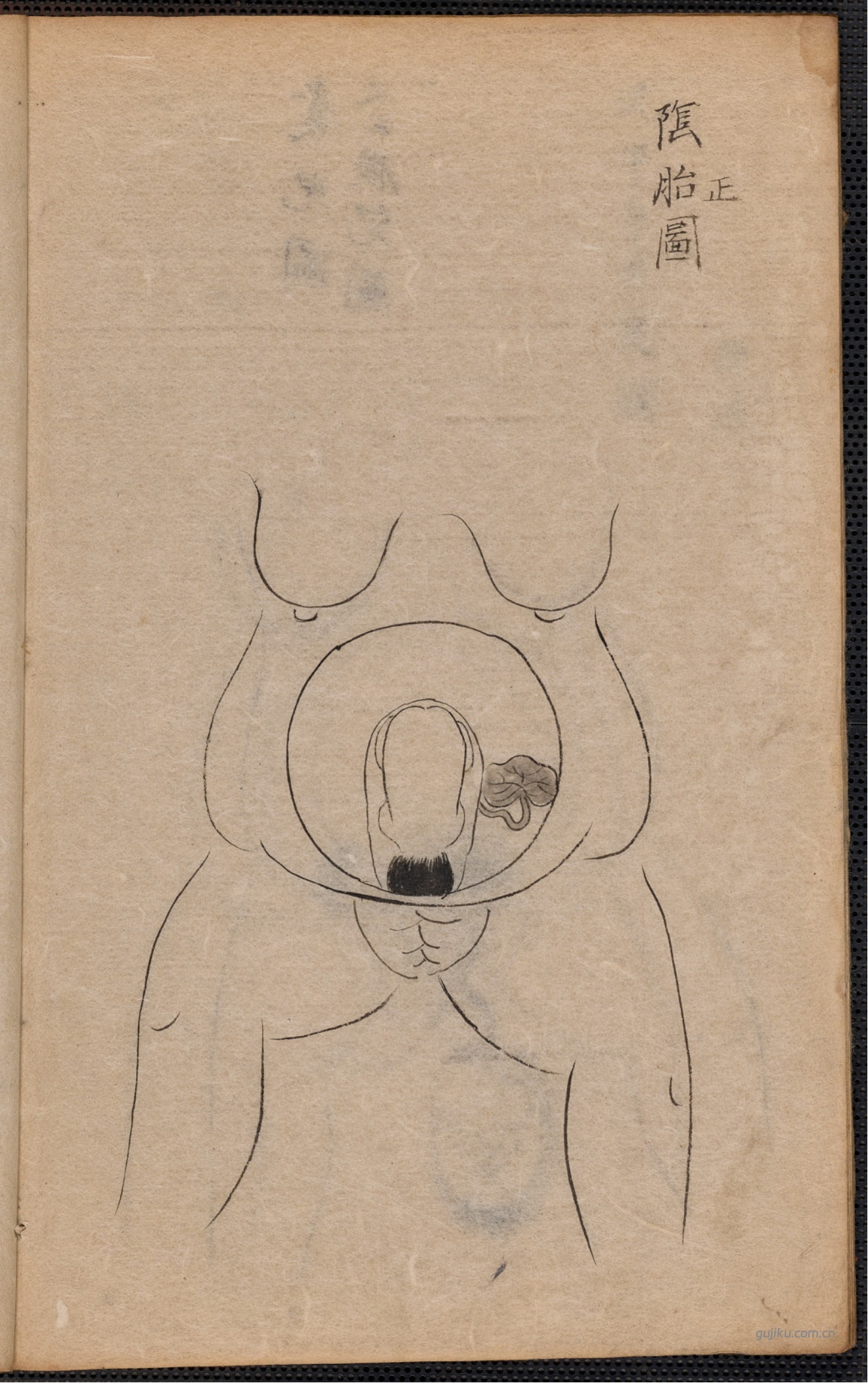 中医产科古籍《蛭田流产科》