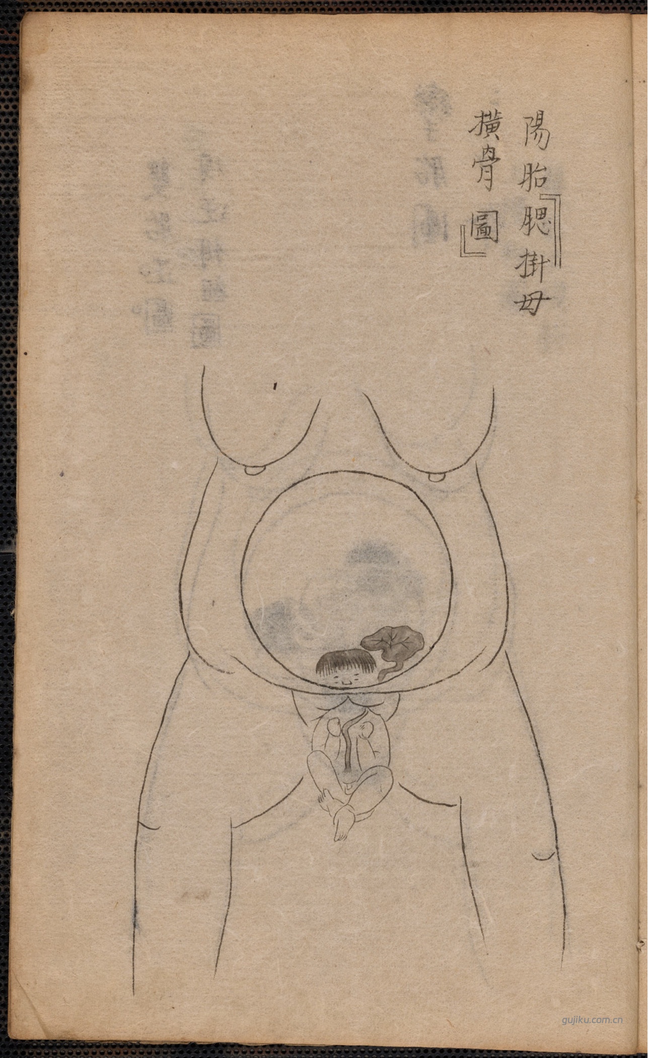 中医产科古籍《蛭田流产科》